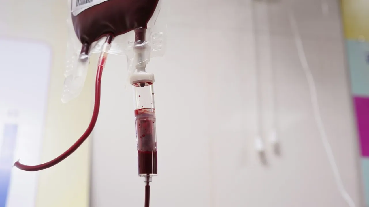 A blood bag with a drip chamber hanging in a clinical setting