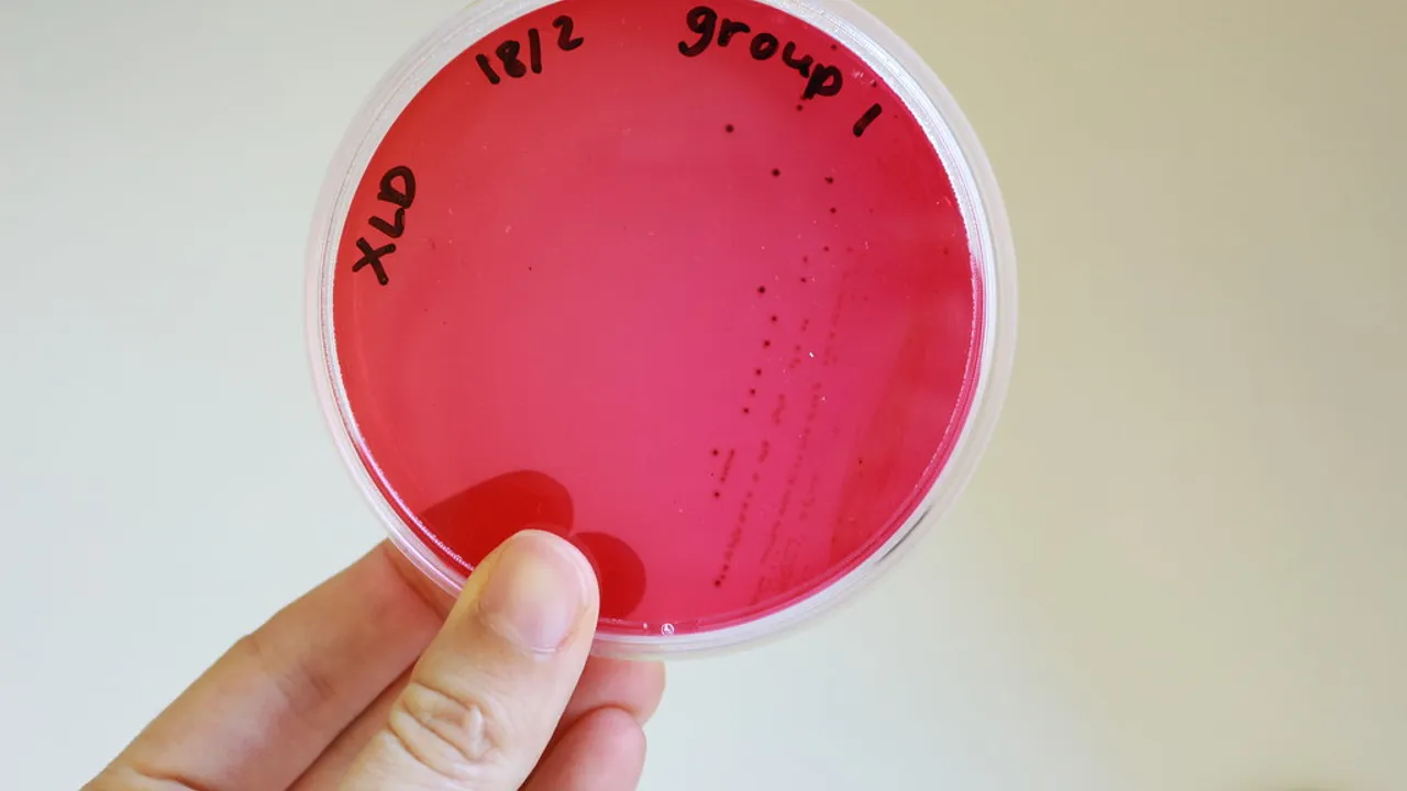 This is what Salmonella looks like.