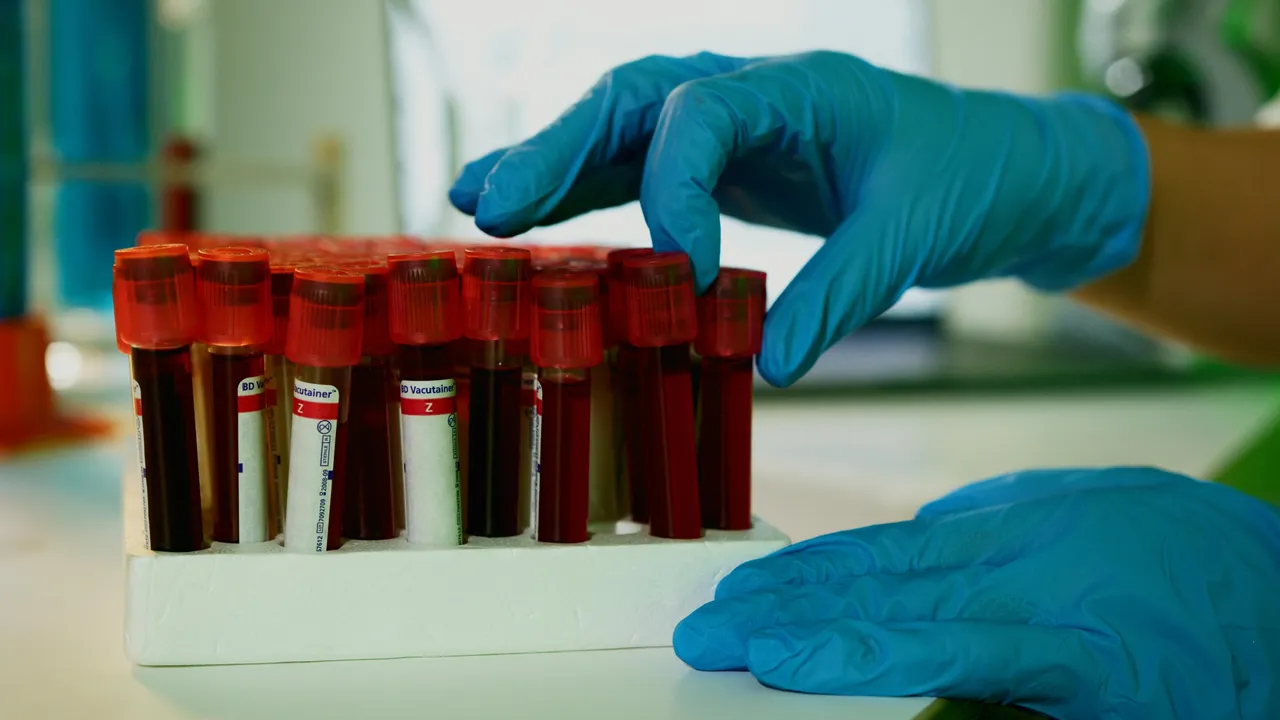 Image from medicalxpress.com: Large European Study Shows Screening Children for Type 1 Diabetes Is Feasible—and May Help Prevent Complications
